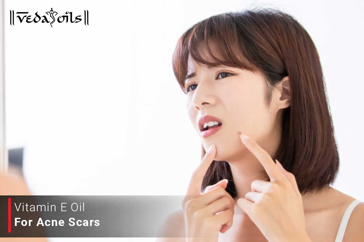 Vitamin E Oil For Acne Combat Pimples At Home